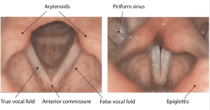 does a tracheal shave change your voice